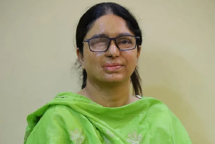Shaheen Malik Acid Attack Survivor and Founder